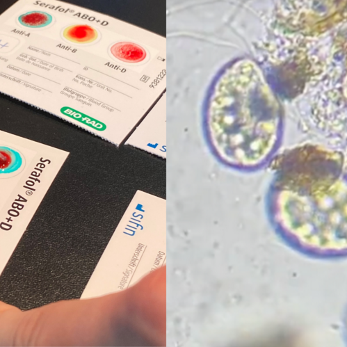 Blutgruppe-Tetrahymena-LiseLab